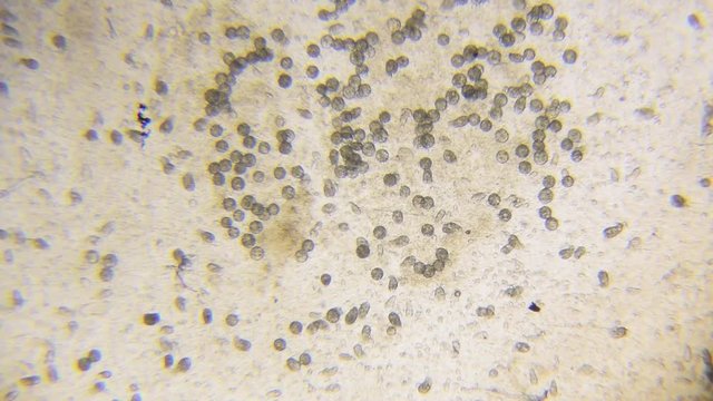 Chlamydomonas algae, paramecium ciliates and many bacteria through microscope