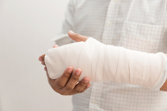 Arm of man splint mild injuries from accidents.