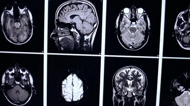 Multiple MRI brain scan, x-ray images