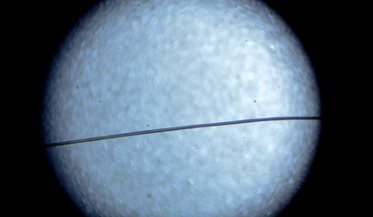 A hair under light microscope