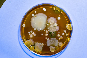 A petri dish with colonies of microorganisms for bacteriological analysis in a microbiological laboratory