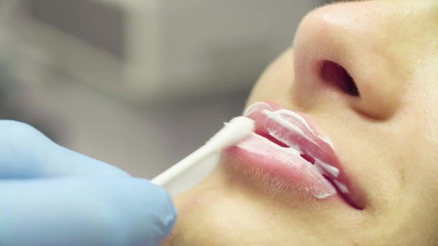 Doctor applying cream on the patient's lips