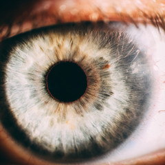 enlarged image of an eye iris made with a slit lamp