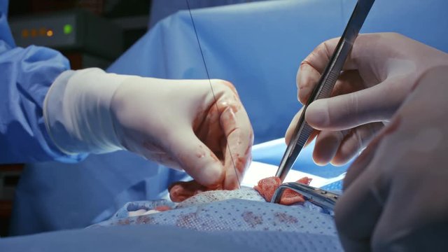 Close up of gloved hands of surgeon and assistant stitching incision during operation