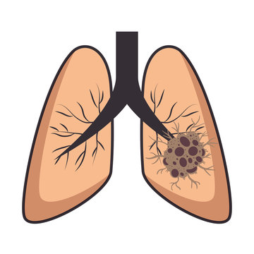 lung cancer isolated icon vector illustration design