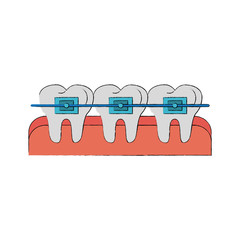 Teeths with brackets icon vector illustration graphic design