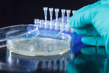 Scientist hand  picks up bacterial colonies for cloning of transgenic vector into plasmid DNA