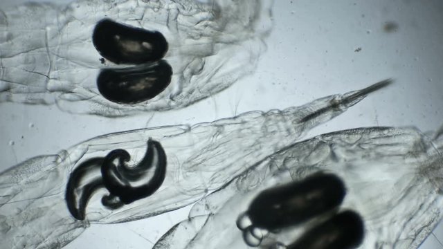 a transparent larva under the microscope,with internal organs,like an alien organism