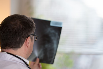 Back turned concentrated doctor reading X-ray images