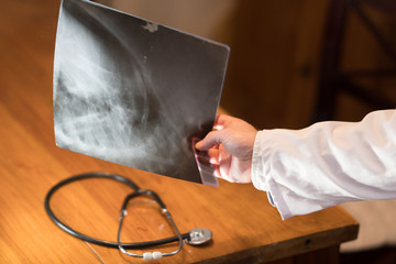 Doctor's hand holding X-ray images