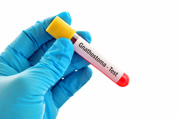 Obraz premium Test tube with blood sample for Gnathostoma parasite test