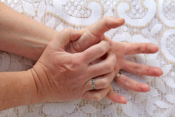 Schmerzen und zitternde Hände bei Senioren. Einer Frau mit Parkinson zittern die Hände