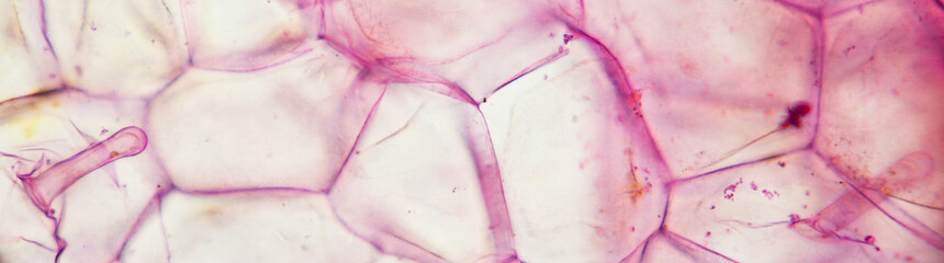 Plant tissue