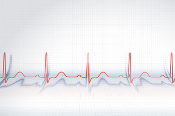 Red line of ECG chart on the background of plotting paper, vector illustration