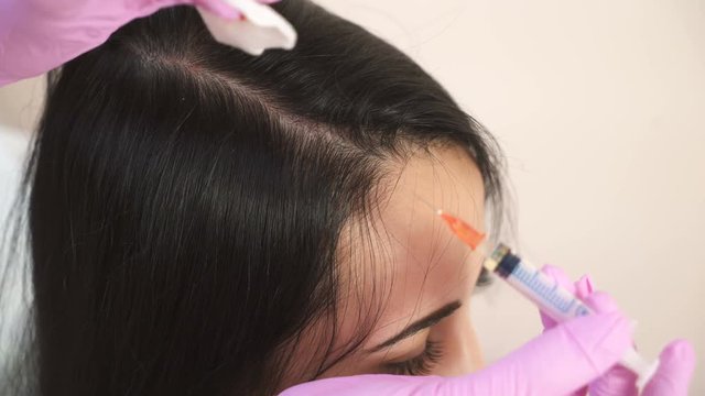Needle mesotherapy. Cosmetologist makes injections into the scalp. Thrust to strengthen hair and their growth