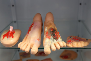 Simulator for medical professionals. Artificial legs with injuries of varying severity