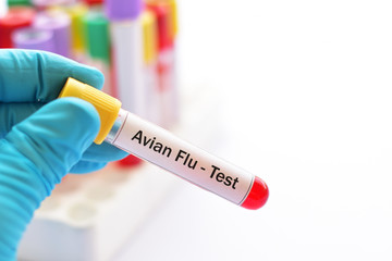 Obraz premium Test tube with blood sample for Avian influenza virus test