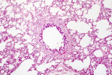 Cross-section of human lung tissue showing bronchiole and alveoli, histology, micrograph, photo...