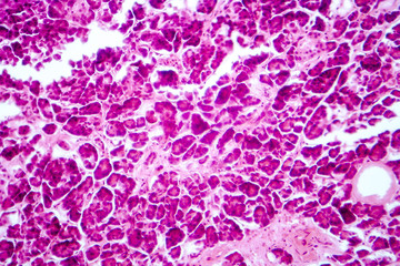 Histology of human pancreatic tissue. Light micrograph of pancreas showing islets where insulin is produced
