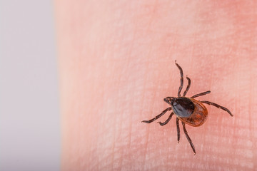 Close-up of castor bean tick on a human finger skin. Ixodes ricinus. Dangerous parasite that sucks blood and transmits infections such as encephalitis and Lyme borreliosis.