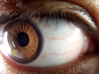 Eye close up