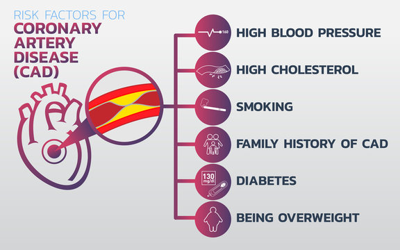 Ischemic heart disease, Ischemic Cardiomyopathy, coronary artery disease (CAD) icon design, infographic health, medical infographic. Vector illustration