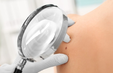 Oncologist examining patient with magnifier in clinic. Cancer awareness