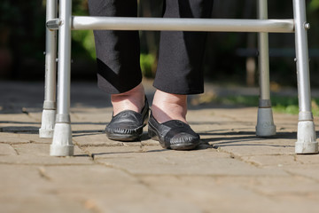 Elderly woman swollen feet use walker in backyard