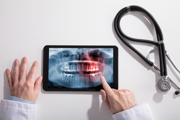 Doctor's Hand And Digital Tablet Screen Showing Teeth X-ray