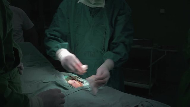 Surgeon hands in protective gloves close up using sterile gauze to cleaning and bandaging patient  stitched surgical cut on stomach, surgery operation in operating room, steady cam, tilt up, crane