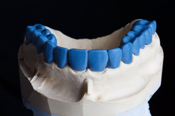 Template with blue wax teeth at right angles