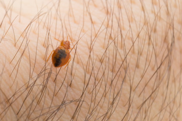 Bed bug creeps on the body of a person in a macro