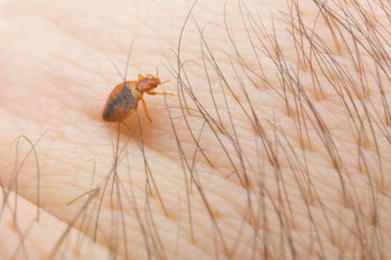 Bed bug on the human body in a macro