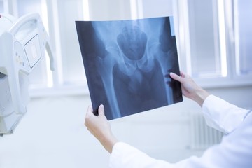 Doctor holding x-ray of a human pelvis