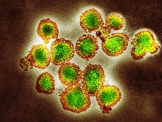 H3N2 influenza virus particles, TEM