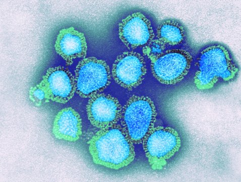H3N2 influenza virus particles, TEM