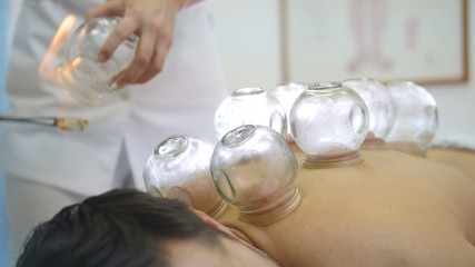 Alternative Asian Tibetan medicine, treatment using glass jars, jars placement