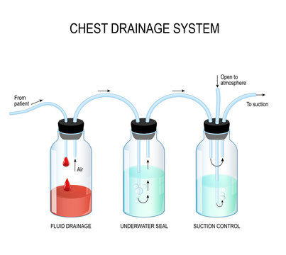 Chest drainage system