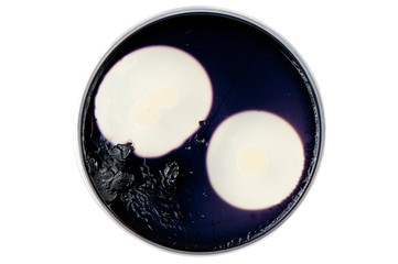 Bacteria growing in a petri dish