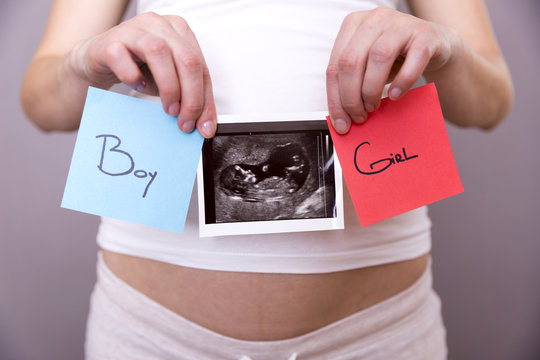 Pregnant woman holding ultrasound scan and blue and red post its with words boy or girl