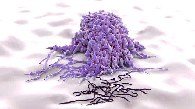 Makrophage frisst Borrelien. Makrophagen sind Zellen des Immunsystems und beseitigen Mikroorganismen durch Phagozytose.