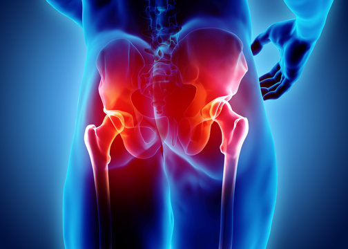 Hip painful skeleton x-ray, 3D illustration.