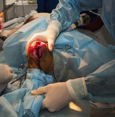 Knee joint (rupture of the anterior cross-linked double osteotomy of the leg)