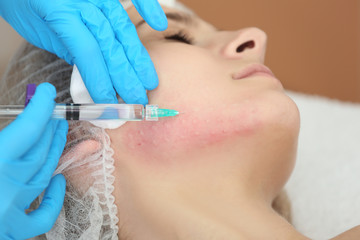 Beautician making injection in woman's face, closeup. Biorevitalization procedure