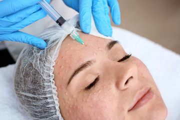 Beautician making injection in woman's face, closeup. Biorevitalization procedure