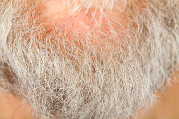 Senior man's grey beard on chin