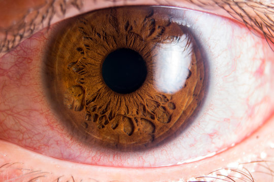 Ojo rojo
