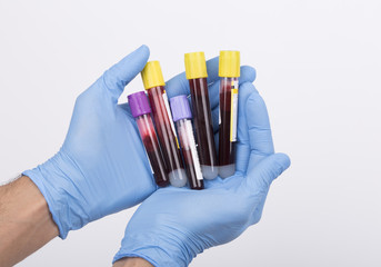 blood test tubes white background