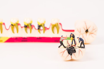 miniature people and dental model,dental care concept