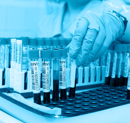test tubes with blood for analysis
